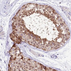 Invitrogen CGI58 Polyclonal Antibody 100 &mu;L; Unconjugated:Antibodies,