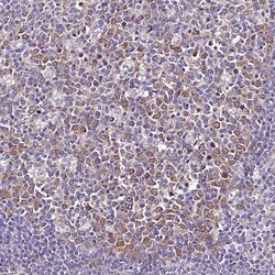 Invitrogen CGI58 Polyclonal Antibody 100 &mu;L; Unconjugated:Antibodies,