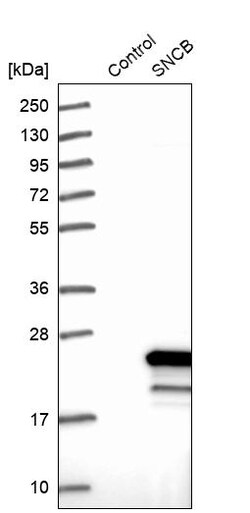 Invitrogen beta Synuclein Polyclonal Antibody 100 &mu;L; Unconjugated:Anticuerpos