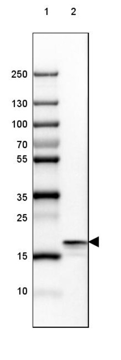 Invitrogen beta Synuclein Polyclonal Antibody 100 &mu;L; Unconjugated:Anticuerpos