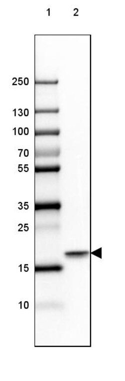 Invitrogen beta Synuclein Polyclonal Antibody 100 &mu;L; Unconjugated:Anticuerpos