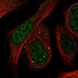Invitrogen SLU7 Polyclonal Antibody 100 &mu;L; Unconjugated:Antibodies,