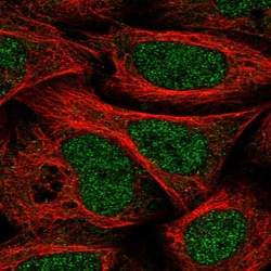Invitrogen DCUN1D1 Polyclonal Antibody 100 &mu;L; Unconjugated:Antibodies,