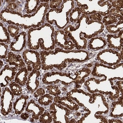 Invitrogen CSN3 (CASK) Polyclonal Antibody 100 &mu;L; Unconjugated:Antibodies,