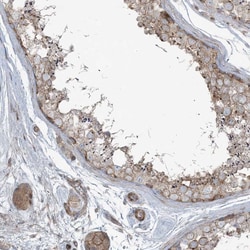 Invitrogen PIK3R4 Polyclonal Antibody 100 &mu;L; Unconjugated:Antibodies,