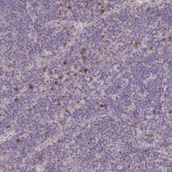 Invitrogen FceR1 alpha Polyclonal Antibody 100 &mu;L; Unconjugated:Antibodies,
