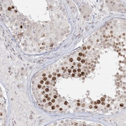 Invitrogen BRK Polyclonal Antibody 100 &mu;L; Unconjugated:Antibodies,