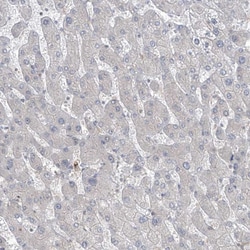 Invitrogen PPAT Polyclonal Antibody 100 &mu;L | Buy Online | Invitrogen&trade; | Fisher Scientific