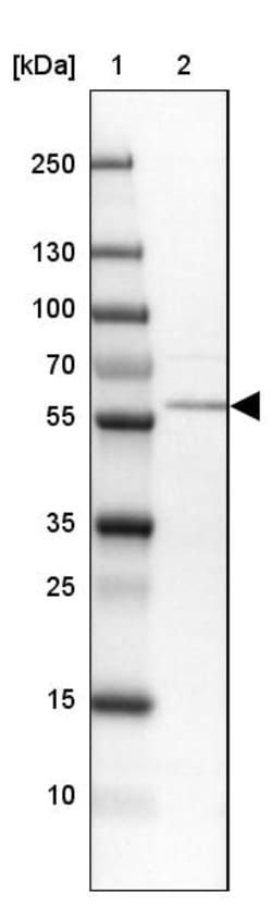 Invitrogen PPAT Polyclonal Antibody 100 &mu;L | Buy Online | Invitrogen&trade; | Fisher Scientific