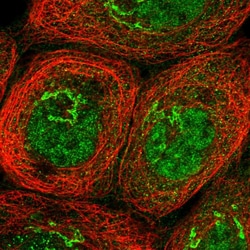 Invitrogen HKR1 Polyclonal Antibody 100 &mu;L; Unconjugated:Antibodies,