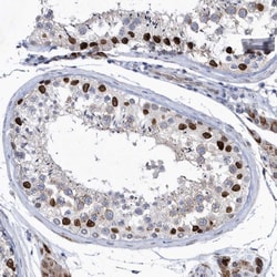 Invitrogen HKR1 Polyclonal Antibody 100 &mu;L; Unconjugated:Antibodies,