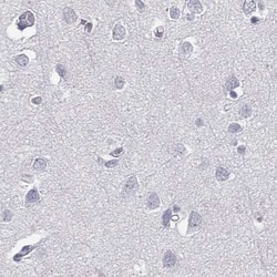 Invitrogen C6orf58 Polyclonal Antibody 100 &mu;L | Buy Online | Invitrogen&trade; | Fisher Scientific