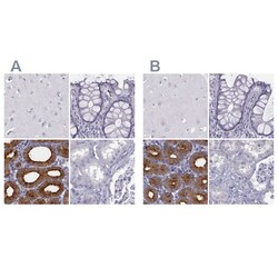 Invitrogen C6orf58 Polyclonal Antibody 100 &mu;L | Buy Online | Invitrogen&trade; | Fisher Scientific