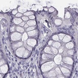 Invitrogen C6orf58 Polyclonal Antibody 100 &mu;L | Buy Online | Invitrogen&trade; | Fisher Scientific
