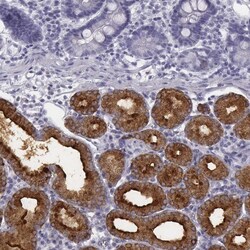 Invitrogen C6orf58 Polyclonal Antibody 100 &mu;L | Buy Online | Invitrogen&trade; | Fisher Scientific