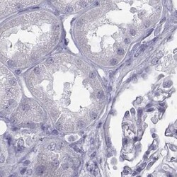 Invitrogen C6orf58 Polyclonal Antibody 100 &mu;L | Buy Online | Invitrogen&trade; | Fisher Scientific