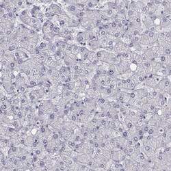 Invitrogen C6orf58 Polyclonal Antibody 100 &mu;L | Buy Online | Invitrogen&trade; | Fisher Scientific