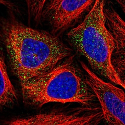 Invitrogen GUSB Polyclonal Antibody 100 &mu;L; Unconjugated:Antibodies,