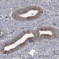 Invitrogen GUSB Polyclonal Antibody 100 &mu;L; Unconjugated:Antibodies,