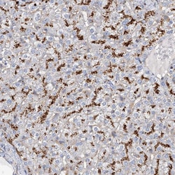 Invitrogen GUSB Polyclonal Antibody 100 &mu;L; Unconjugated:Antibodies,