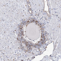 Invitrogen GUSB Polyclonal Antibody 100 &mu;L; Unconjugated:Antibodies,