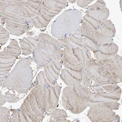 Invitrogen GUSB Polyclonal Antibody 100 &mu;L; Unconjugated:Antibodies,