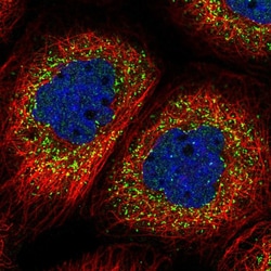 Invitrogen ALS2CR1 Polyclonal Antibody 100 &mu;L; Unconjugated:Antibodies,