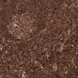 Invitrogen ALS2CR1 Polyclonal Antibody 100 &mu;L; Unconjugated:Antibodies,
