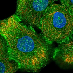 Invitrogen CD104 Polyclonal Antibody 100 &mu;L; Unconjugated:Antibodies,