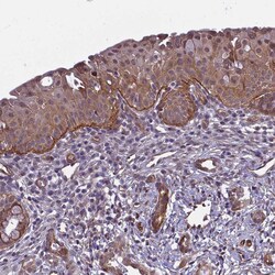 Invitrogen CD104 Polyclonal Antibody 100 &mu;L; Unconjugated:Antibodies,