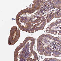 Invitrogen CD104 Polyclonal Antibody 100 &mu;L; Unconjugated:Antibodies,