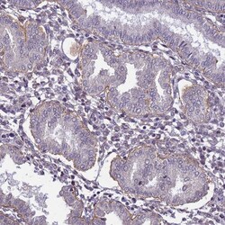 Invitrogen CD104 Polyclonal Antibody 100 &mu;L; Unconjugated:Antibodies,