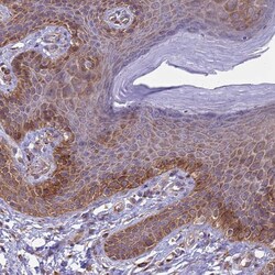 Invitrogen CD104 Polyclonal Antibody 100 &mu;L; Unconjugated:Antibodies,
