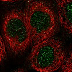 Invitrogen GCLC Polyclonal Antibody 100 &mu;L; Unconjugated:Antibodies,