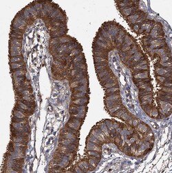 Invitrogen GCLC Polyclonal Antibody 100 &mu;L; Unconjugated:Antibodies,