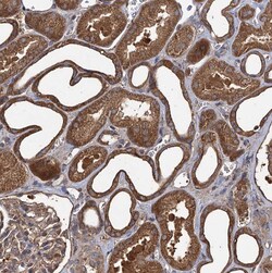 Invitrogen GCLC Polyclonal Antibody 100 &mu;L; Unconjugated:Antibodies,