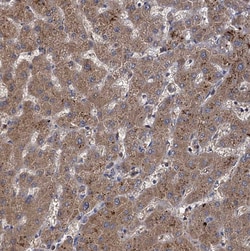 Invitrogen GCLC Polyclonal Antibody 100 &mu;L; Unconjugated:Antibodies,