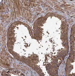 Invitrogen GCLC Polyclonal Antibody 100 &mu;L; Unconjugated:Antibodies,