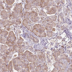 Invitrogen RASA1 Polyclonal Antibody 100 &mu;L | Buy Online | Invitrogen&trade; | Fisher Scientific