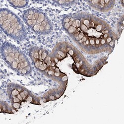 Invitrogen NHE3 Polyclonal Antibody 100 &mu;L; Unconjugated:Antibodies,