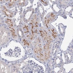 Invitrogen NHE3 Polyclonal Antibody 100 &mu;L; Unconjugated:Antibodies,