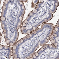 Invitrogen NHE3 Polyclonal Antibody 100 &mu;L; Unconjugated:Antibodies,