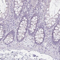 Invitrogen HOMER1 Polyclonal Antibody 100 &mu;L; Unconjugated:Antibodies,