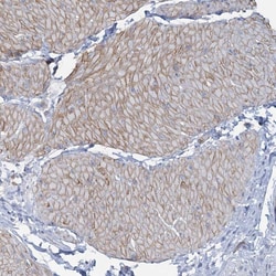 Invitrogen CUEDC2 Polyclonal Antibody 100 &mu;L; Unconjugated:Antibodies,