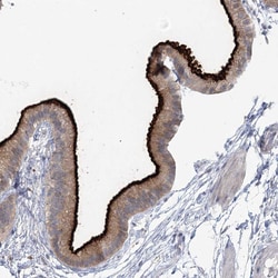 Invitrogen NHE3 Polyclonal Antibody 100 &mu;L; Unconjugated:Antibodies,