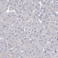 Invitrogen NHE3 Polyclonal Antibody 100 &mu;L; Unconjugated:Antibodies,