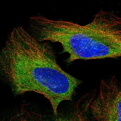 Invitrogen PLCG1 Polyclonal Antibody 100 &mu;L; Unconjugated:Antibodies,