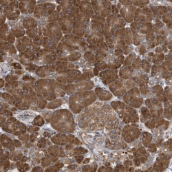 Invitrogen VAMP7 Polyclonal Antibody 100 &mu;L; Unconjugated:Antibodies,