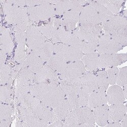 Invitrogen Glucagon Polyclonal Antibody 100 &mu;L; Unconjugated:Anticuerpos