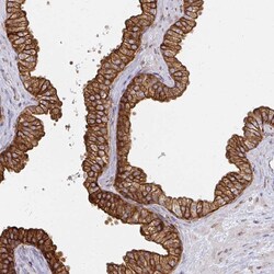 Invitrogen Calpastatin Polyclonal Antibody 100 &mu;L; Unconjugated:Antibodies,